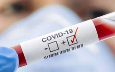 নীলফামারীতে এবার করোনায় আক্রান্ত সাংবাদিক, কৃষি কর্মকর্তাসহ ৪ জন