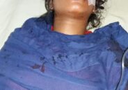 টাঙ্গাইলে মাদক বিক্রিতে রাজি না হওয়ায় স্ত্রীর চোখ তুলে নিলো স্বামী