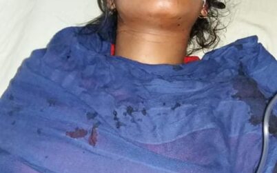 টাঙ্গাইলে মাদক বিক্রিতে রাজি না হওয়ায় স্ত্রীর চোখ তুলে নিলো স্বামী